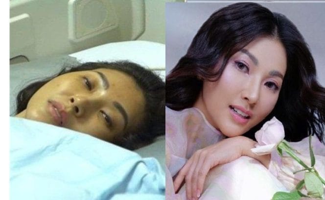 Sarwendah Blak-blakan Soal Kista Batang Otak: Begini Rasanya Saat Kambuh