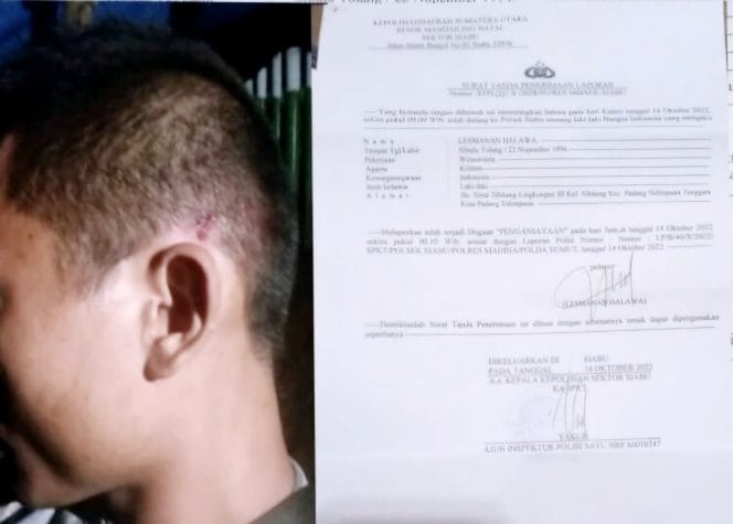 
Keterangan Foto : Wartawan korban kekerasan dan penganiayaan sekelompok orang diduga suruhan juragan tambang emas ilegal di Kabupaten Mandailing Natal (Madina).