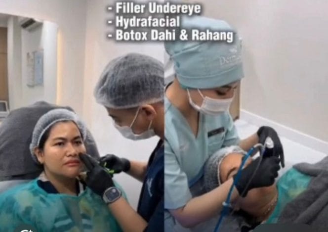 
Keterangan foto: Artis Cantik Camelia Panduwinata saat Rawat Kecantikan di Dermaster Klinik Menteng, Jakarta Pusat.
